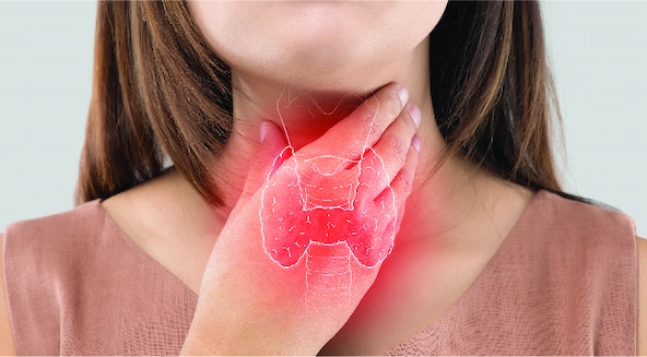 Curiosities About Thyroid Cancer and Radioiodine Treatment